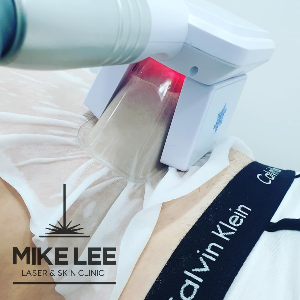 Cryolipolysis (Fat Freezing) at Mike Lee Laser & Skin Clinic