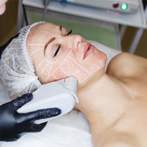 HIFU Skin Tightening at Mike Lee Laser & Skin Clinic