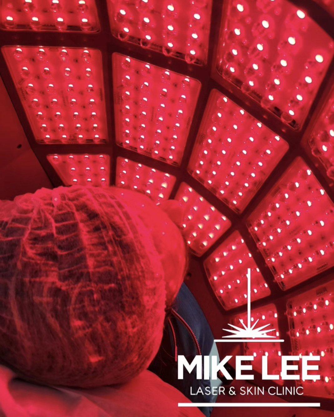 A client under the LED light therapy panel at Mike Lee Laser & Skin Clinic