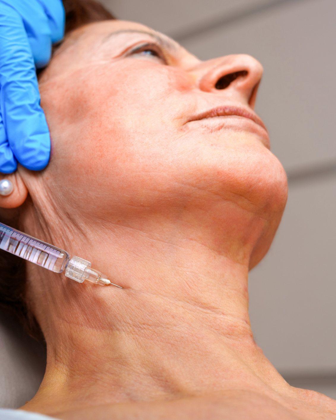 A skin booster injection along the neck at Mike Lee Laser & Skin Clinic