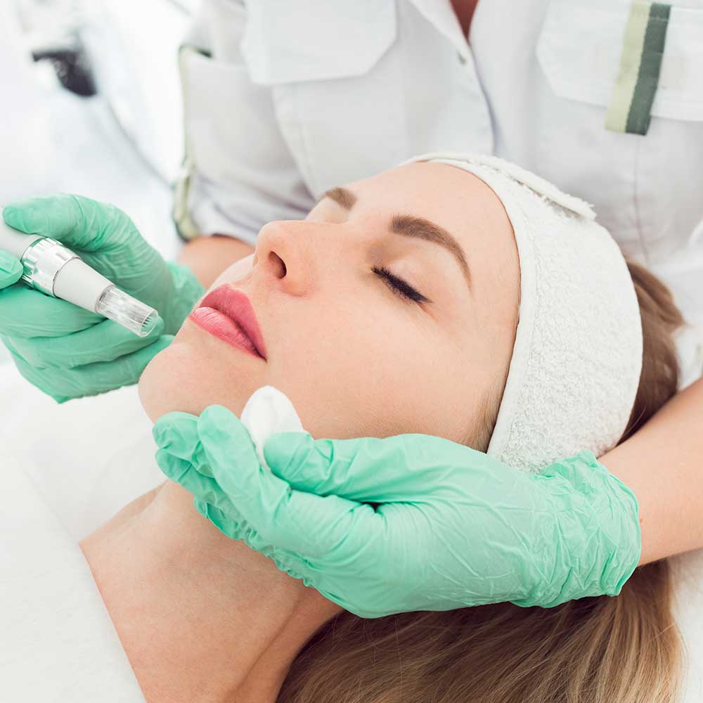 Microneedling at Mike Lee Laser & Skin Clinic